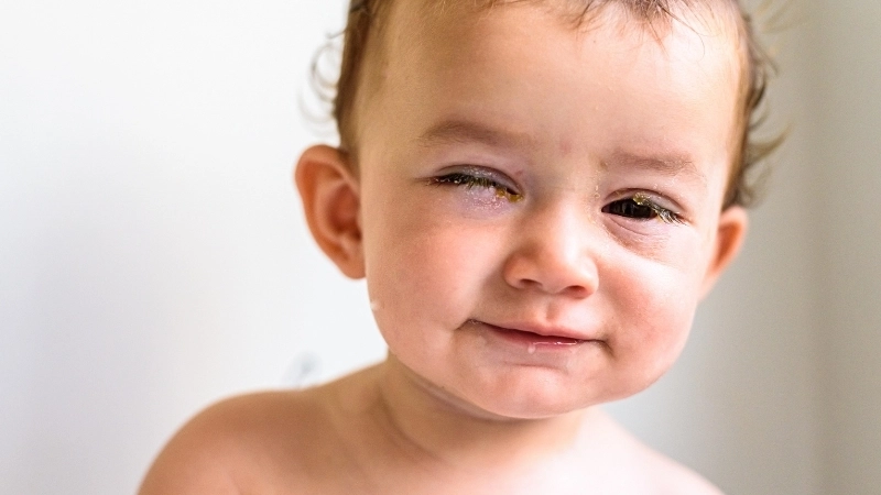 Minh họa cách phòng bệnh đau mắt đỏ hiệu quả