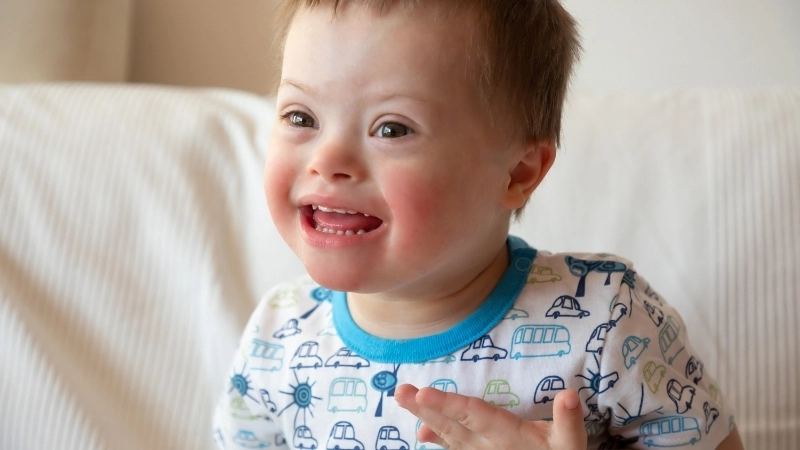 Bộ ảnh về sự phát triển của trẻ mắc bệnh Down