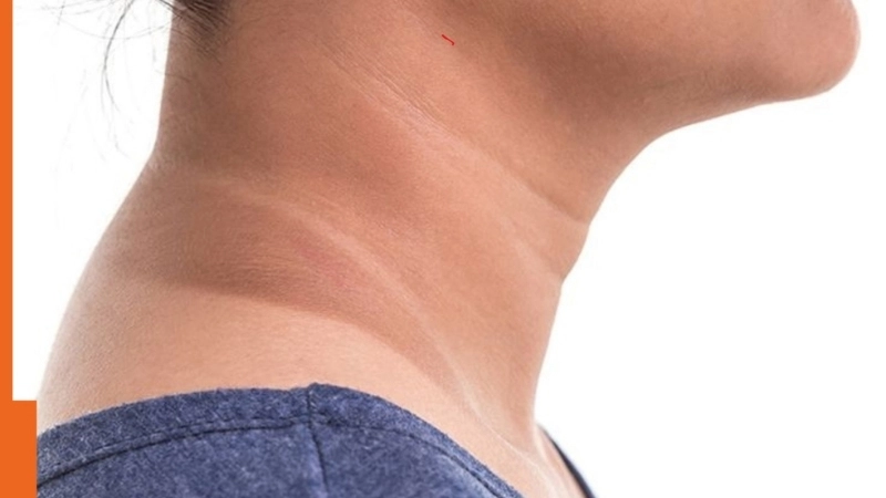 Hình ảnh cảnh báo bệnh gai đen có nguy hiểm không