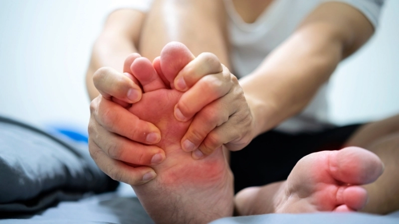 Hình ảnh của bệnh gout gây biến dạng khớp ngón tay