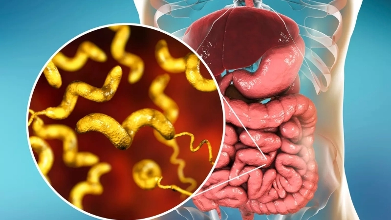 Thực phẩm không vệ sinh là nguyên nhân bệnh kiết lỵ do Trực khuẩn