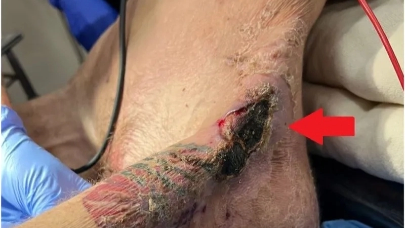 Tư thế lưng ưỡn cong điển hình trong uốn ván