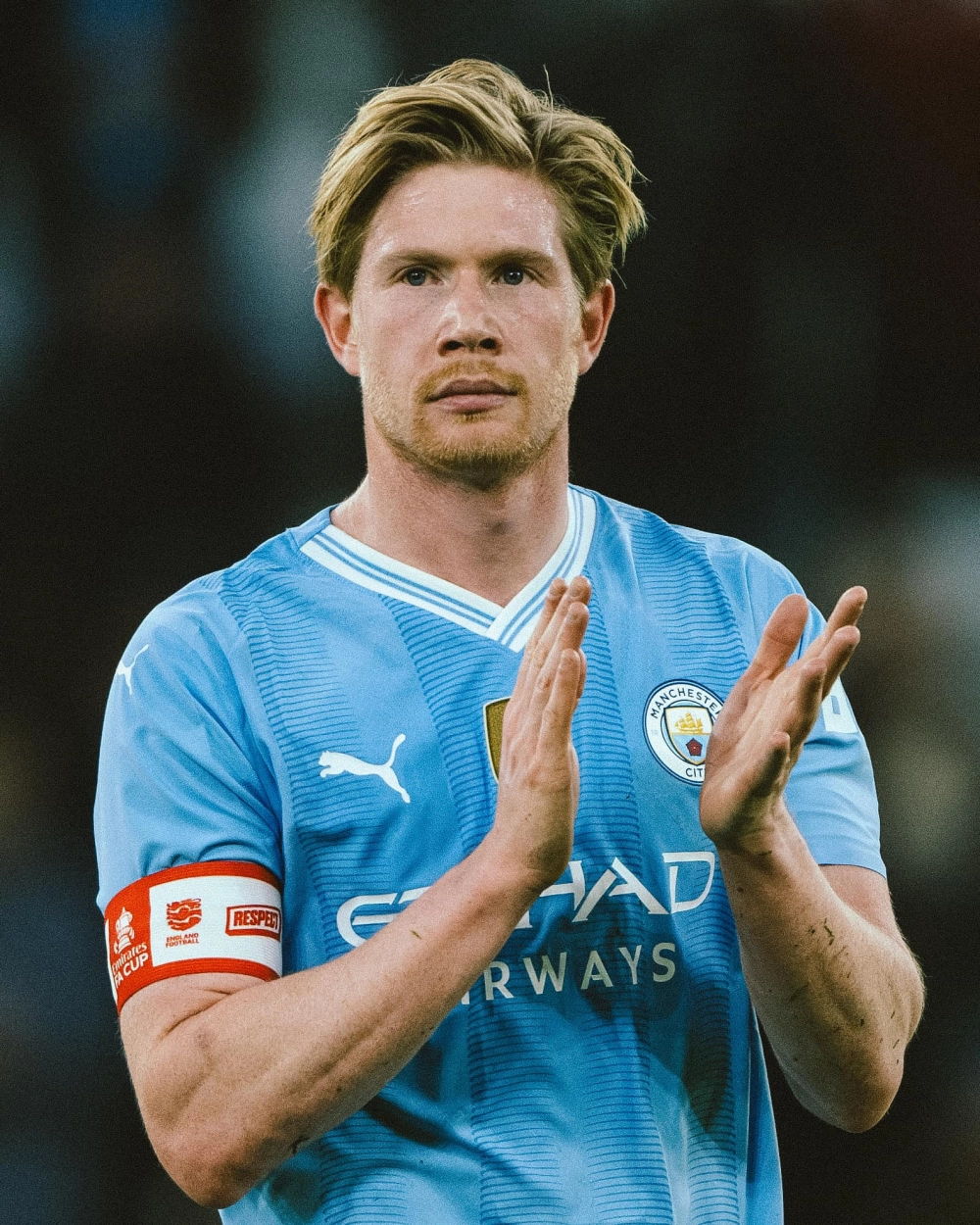 Kevin de bruyne injury khiến người hâm mộ lo lắng