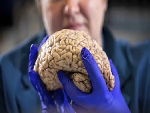 Cận cảnh hình ảnh bệnh alzheimer qua lăng kính khoa học