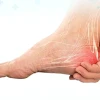 Đau Gót Chân Là Bệnh Gì? Nguyên Nhân Và Cách Xử Lý Hiệu Quả