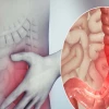 Triệu chứng nhận biết viêm đại tràng và cách khắc phục hiệu quả