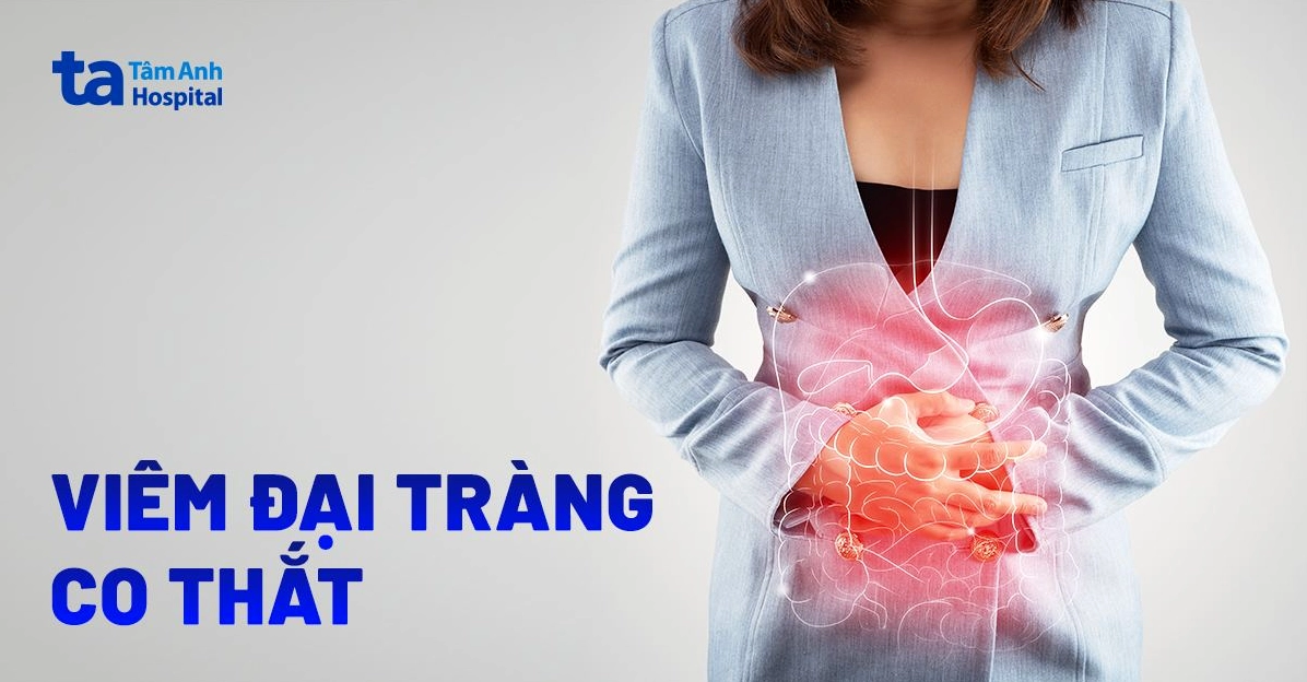Bệnh đại tràng co thắt những điều cần biết và cách xử lý