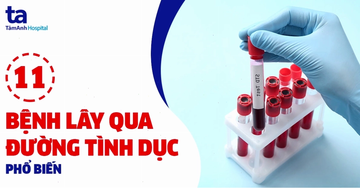 Bệnh lây qua đường tình dục