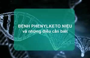 Bệnh Phenylketo niệu là đột biến gì và những điều cần biết