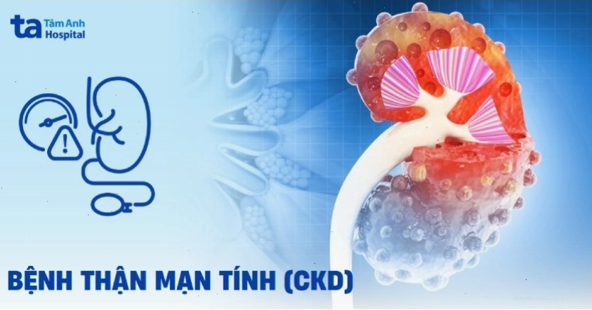Bệnh thận mạn tính cần chế độ ăn uống đặc biệt