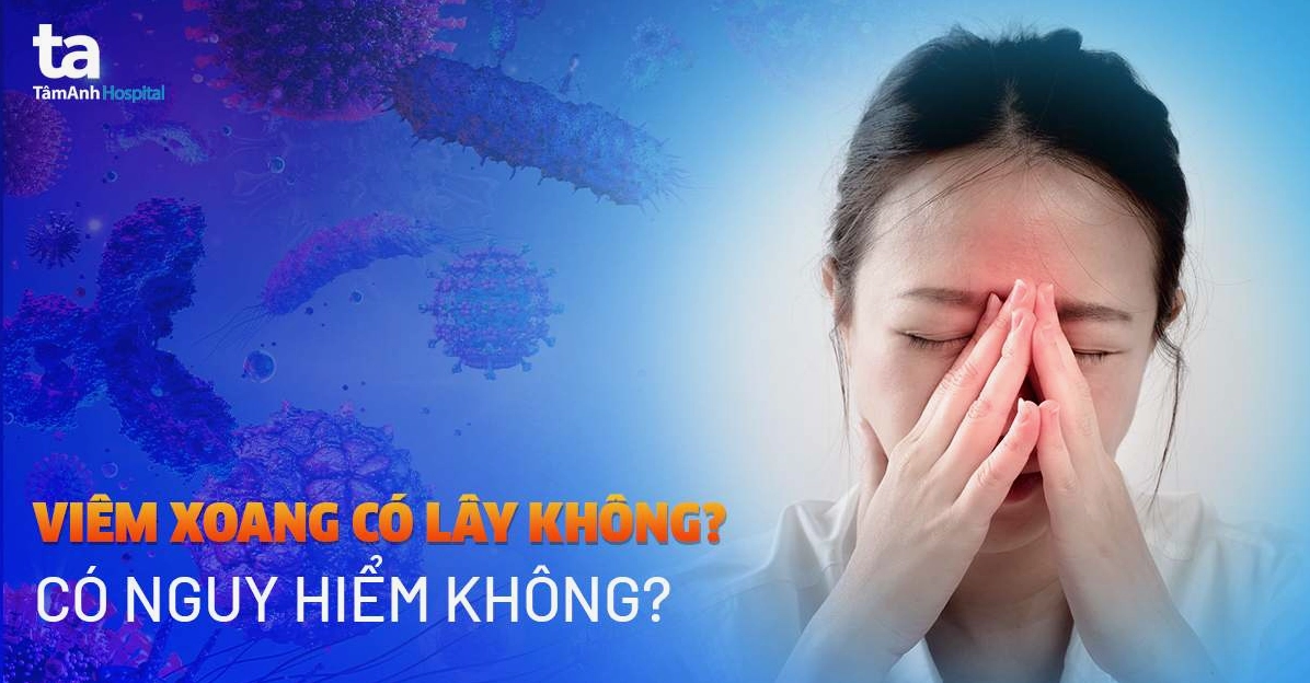 Bệnh Xoang Có Lây Không? Giải Đáp Chi Tiết và Cách Điều Trị Hiệu Quả