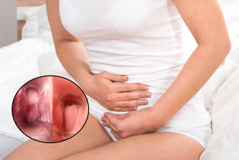 Bí quyết chữa bệnh phụ khoa tại nhà hiệu quả và an toàn