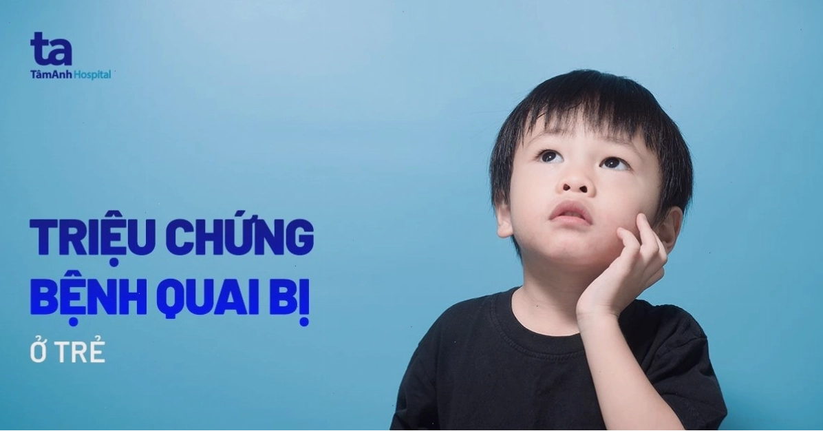 Các dấu hiệu bệnh quai bị ở trẻ em cần theo dõi sát sao