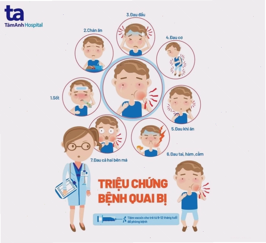 Các triệu chứng điển hình của bệnh quai bị ở trẻ em là sưng tuyến nước bọt mang tai