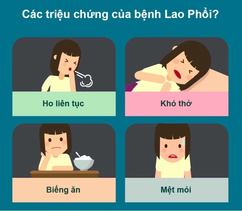 Các triệu chứng lao phổi điển hình như ho kéo dài, sốt về chiều