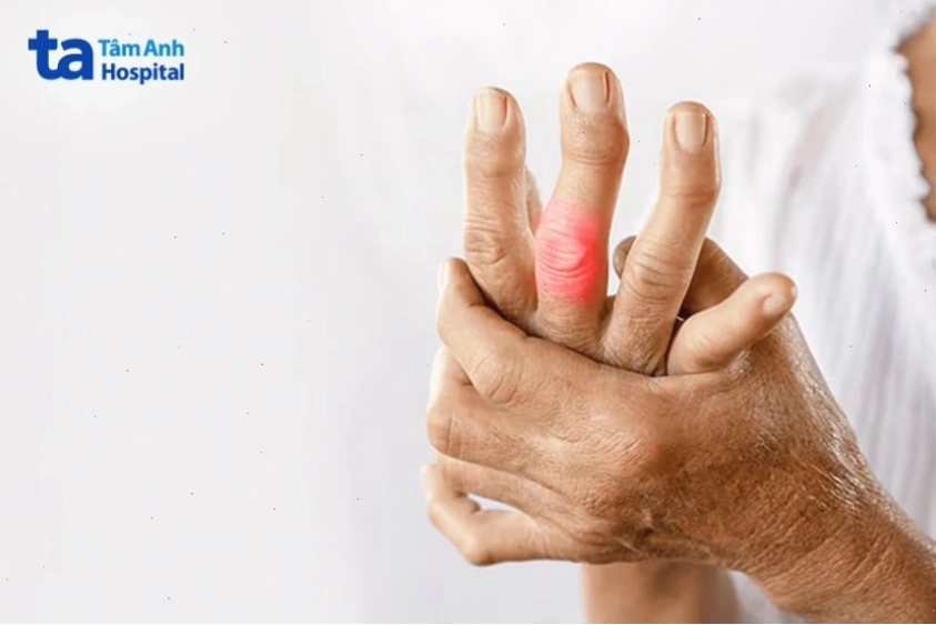 Các yếu tố gây đau khớp ngón tay