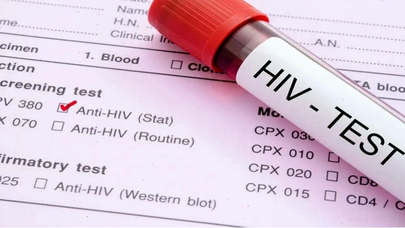 Chủ động thăm khám khi có dấu hiệu nghi ngờ HIV