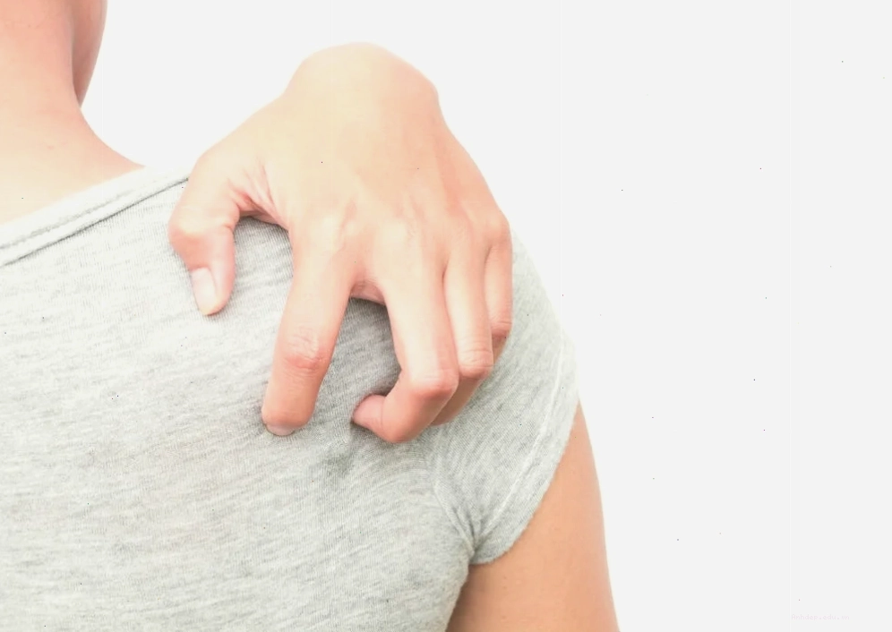 Da bị lác đồng tiền