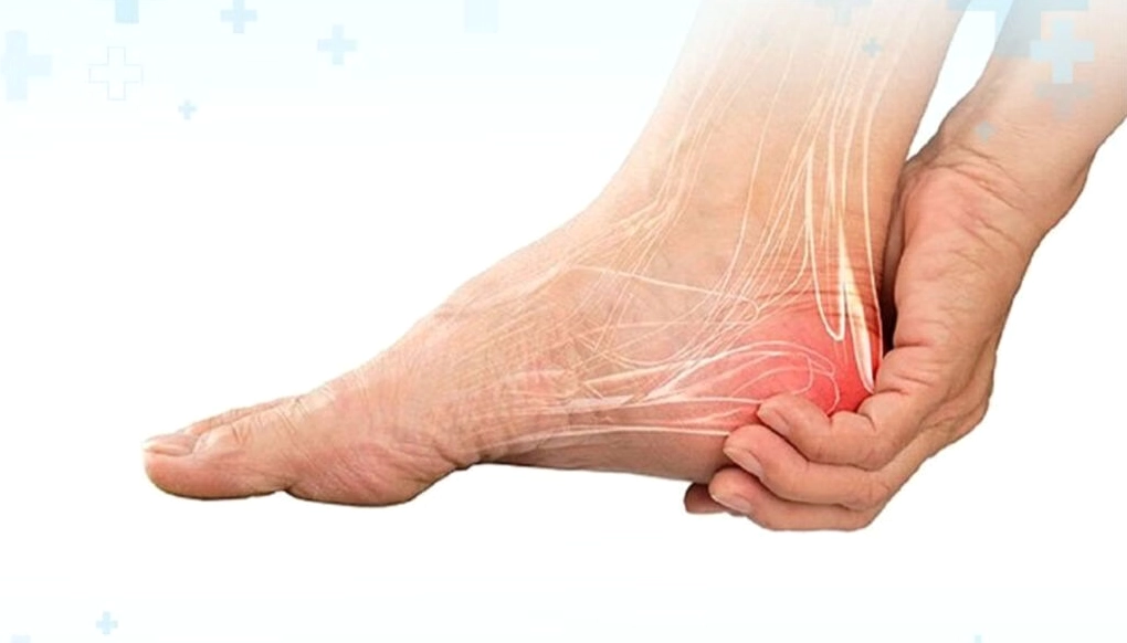 Đau Gót Chân Là Bệnh Gì? Nguyên Nhân Và Cách Xử Lý Hiệu Quả