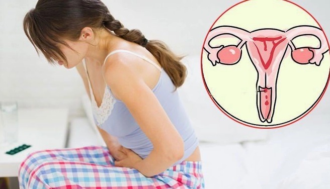Dấu hiệu nhận biết sớm ung thư cổ tử cung