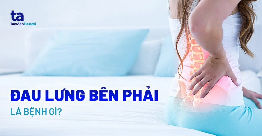 Đau lưng meme: Khi cơ thể lên tiếng, dân mạng "cười ra nước mắt"