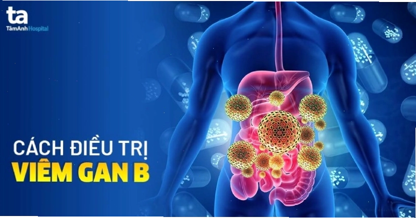 Điều trị viêm gan B
