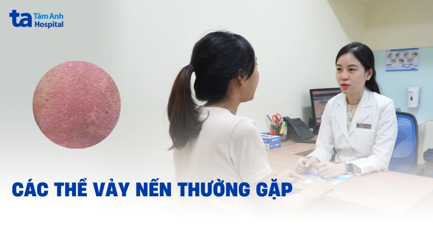 Hình ảnh bệnh vảy nến toàn thân: Dấu hiệu nhận biết và cách chăm sóc hiệu quả