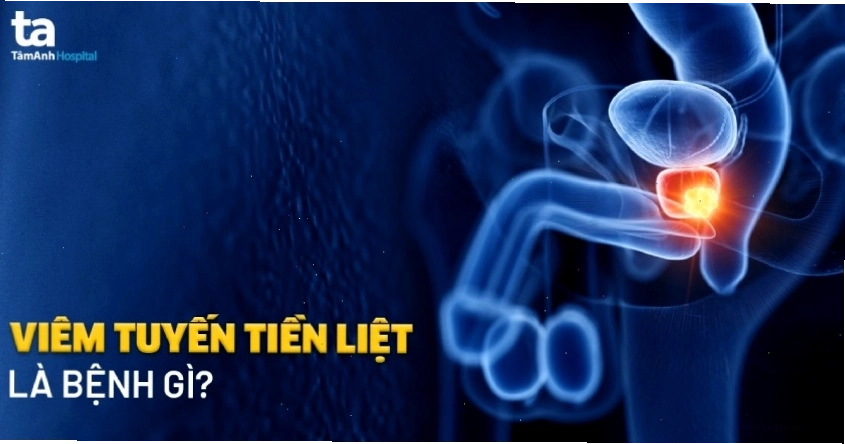 Hình ảnh minh họa cấu trúc tuyến tiền liệt
