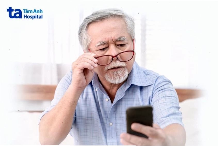 Hình ảnh so sánh mắt bình thường và mắt bị cườm mắt với dấu hiệu nhìn mờ