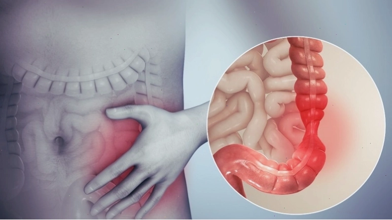 Hội chứng ruột kích thích gây tiêu chảy kéo dài