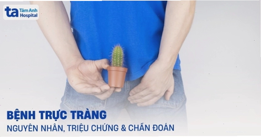Minh họa cấu trúc trực tràng và các bệnh lý liên quan