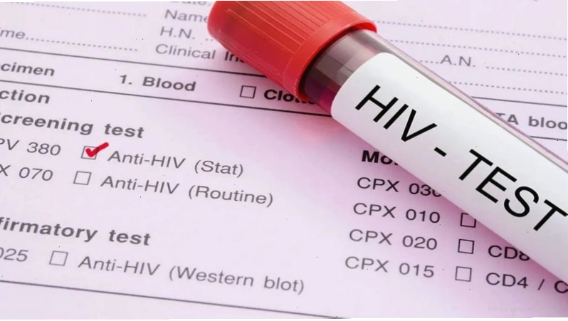 Nam giới cần chủ động thăm khám nếu phát hiện các dấu hiệu nghi ngờ mắc HIV