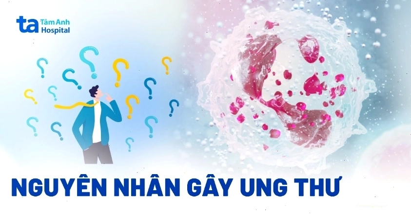 Nhiều yếu tố kết hợp tạo nên nguyên nhân gây ung thư
