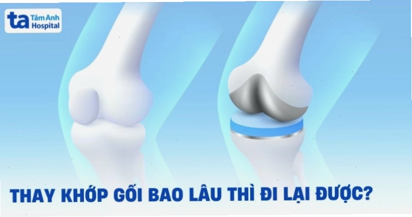 Phẫu thuật thay khớp