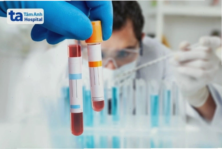 Quy trình nội soi đại trực tràng chẩn đoán bệnh