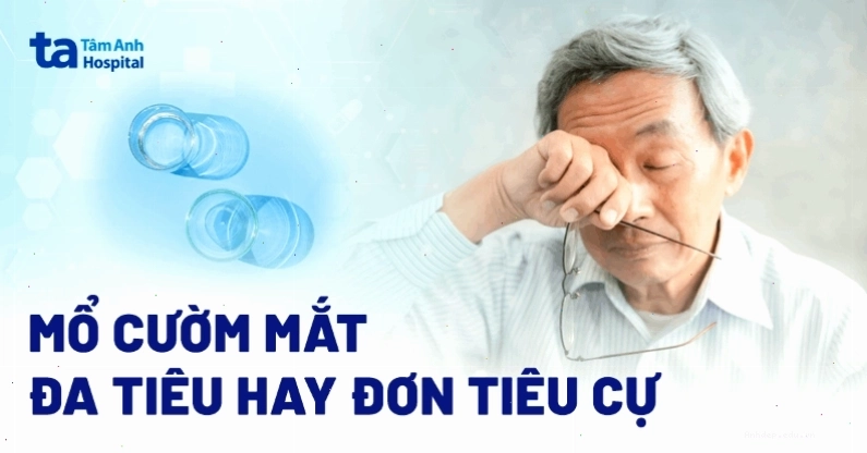 So sánh thủy tinh thể nhân tạo đơn tiêu và đa tiêu cự