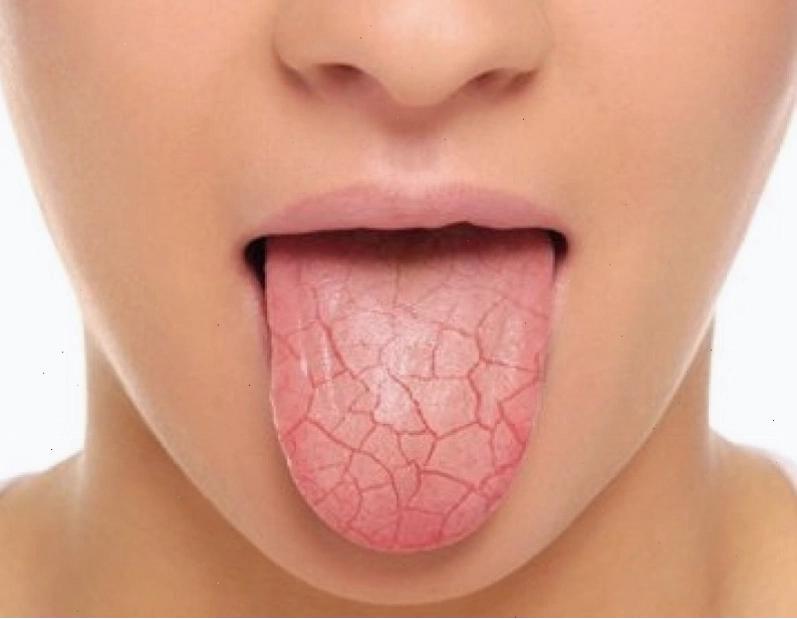 Thiếu nước là nguyên nhân phổ biến gây khô miệng khi ngủ dậy