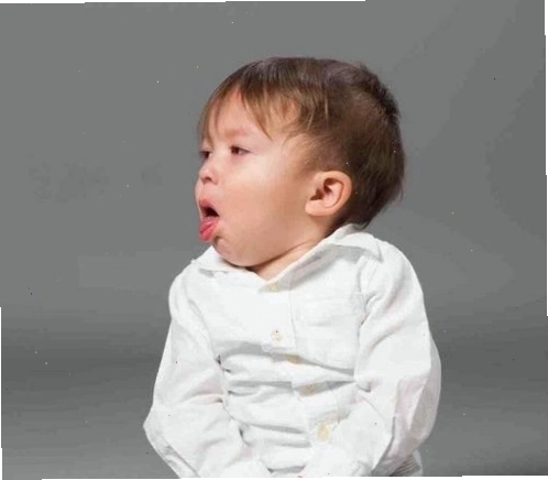 Trẻ em bị sởi có các triệu chứng ho và sốt kéo dài