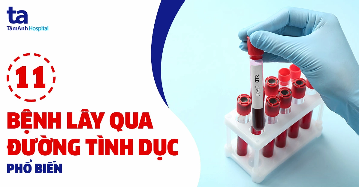Triệu chứng bệnh lây qua đường sinh dục và cách nhận biết sớm
