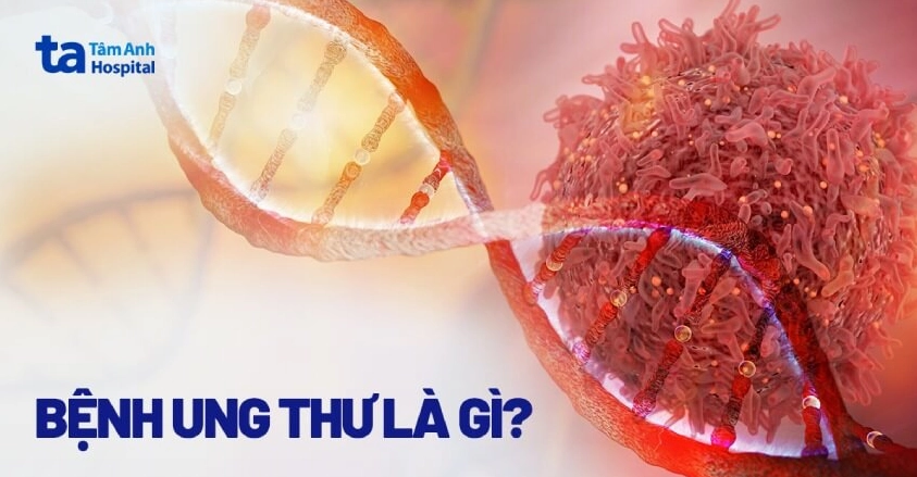 Ung thư là bệnh gì? Hiểu rõ nguyên nhân và cách phòng ngừa hiệu quả
