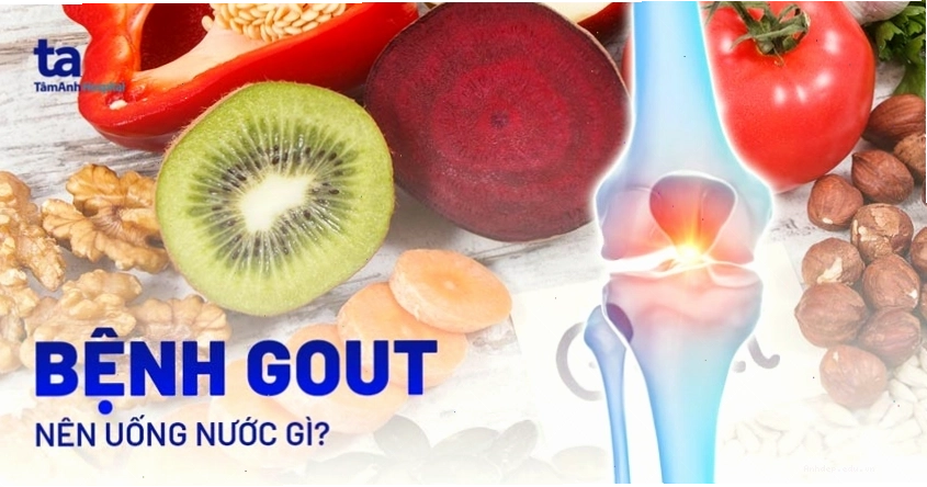 Uống đủ nước hỗ trợ đào thải acid uric