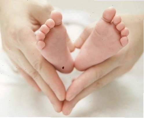 Xét nghiệm lấy máu gót chân chẩn đoán bệnh Phenylketo niệu