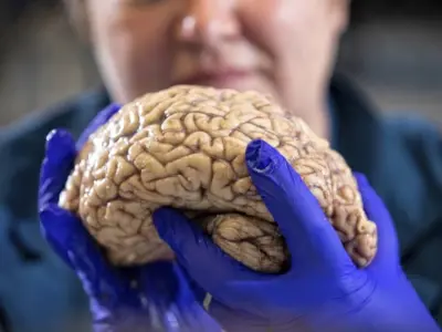 Cận cảnh hình ảnh bệnh alzheimer qua lăng kính khoa học