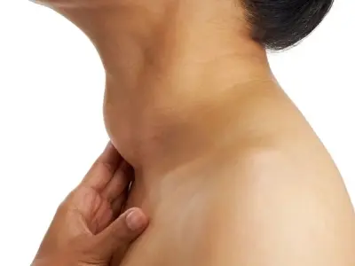 Hình ảnh bệnh bướu cổ - Nhận biết các loại và kích thước bướu