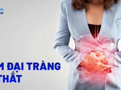 Bệnh đại tràng co thắt những điều cần biết và cách xử lý