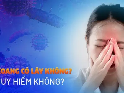 Bệnh Xoang Có Lây Không? Giải Đáp Chi Tiết và Cách Điều Trị Hiệu Quả