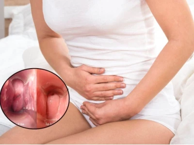 Bí quyết chữa bệnh phụ khoa tại nhà hiệu quả và an toàn
