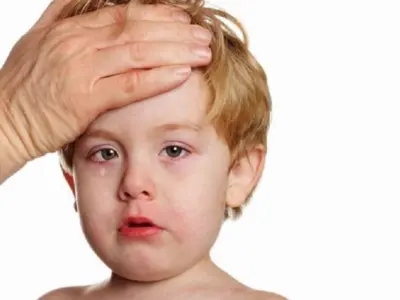 Dấu hiệu bệnh quai bị ở trẻ em: Nhận biết sớm và cách xử lý