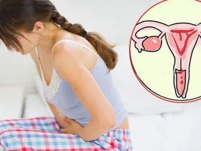 Dấu hiệu nhận biết sớm ung thư cổ tử cung