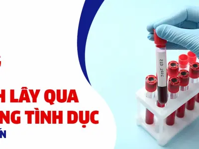 Triệu chứng bệnh lây qua đường sinh dục và cách nhận biết sớm
